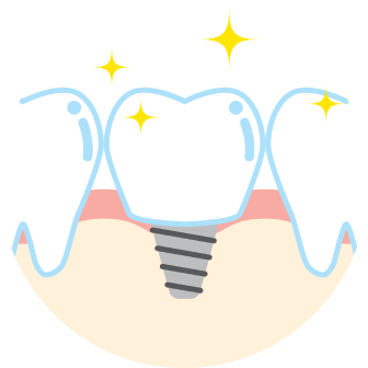 周囲の歯を削る必要がない